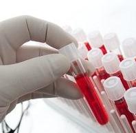 Биохимический анализ крови расшифровка у взрослых норма в таблице