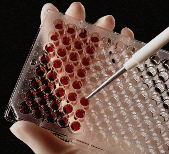 Биохимический анализ крови расшифровка у взрослых норма в таблице